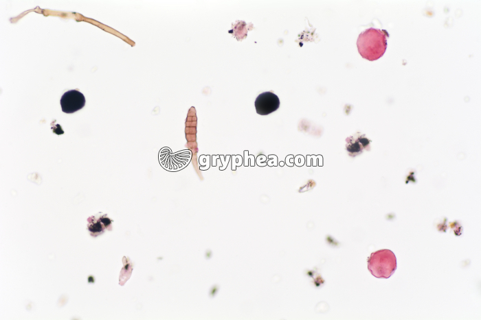 Pneumallergènes atmosphériques x200b - gryphea.org